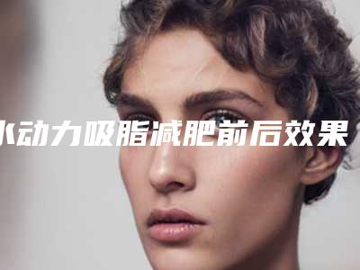 水动力吸脂减肥前后效果对比图和真实案例过程分享