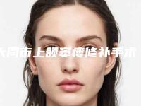 大同市上颌窦瘘修补手术收费明细医生介绍参考-大同市上颌窦瘘修补手术价格