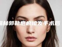 锡林郭勒疤痕植发手术后会有风险吗